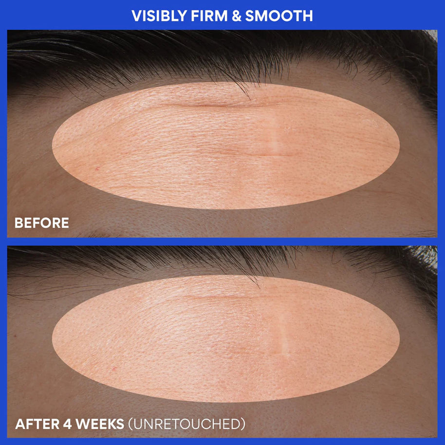 Innisfree Retinol Green Tea PDRN™ Firming Serum 25ml