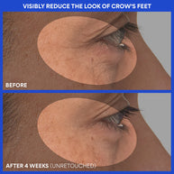 Innisfree Retinol Green Tea PDRN™ Firming Serum 25ml