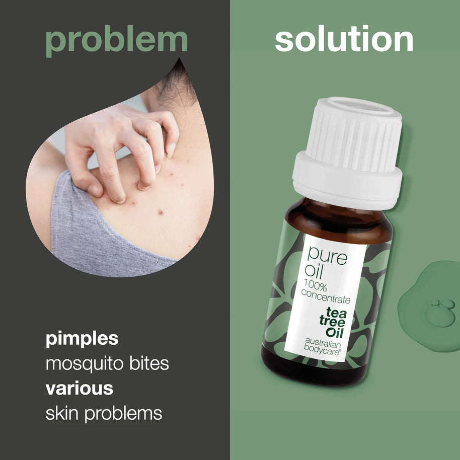 Australian Bodycare Pure Tea Tree Oil 30ml