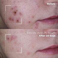 Skin Republic Salicylsäure 2% Serum 30ml