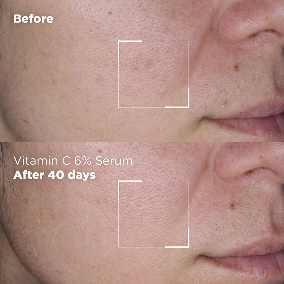 Skin Republic Vitamin C 6% + Alpha Arbutin Serum 30ml