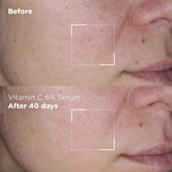 Skin Republic Vitamin C 6% + Alpha Arbutin Serum 30ml