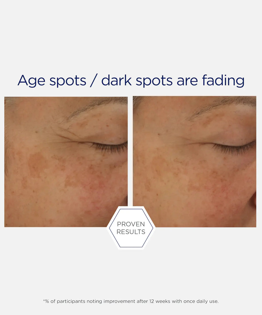 NeoStrata Skin Active Potent Retinol Complex 30ml
