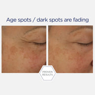 NeoStrata Skin Active Potent Retinol Complex 30ml