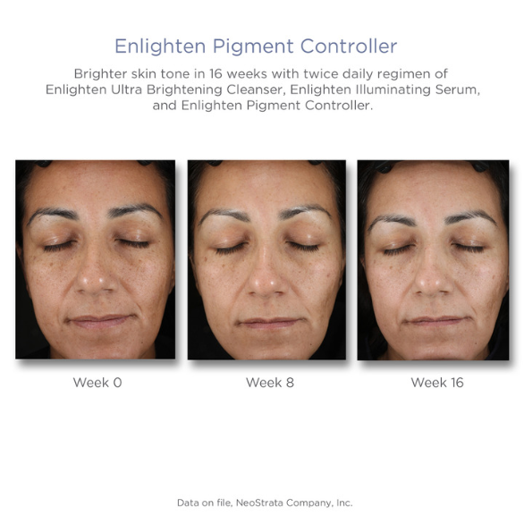 NeoStrata Enlighten Pigment Controller 50ml