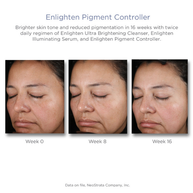 NeoStrata Enlighten Pigment Controller 50ml