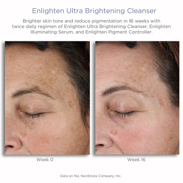 NeoStrata Enlighten Ultra Brightening Cleanser 100ml