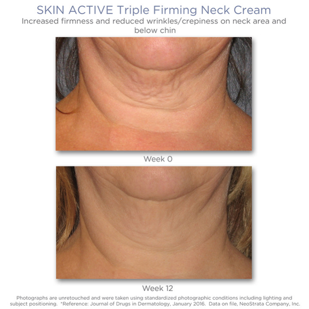 NeoStrata Skin Active Triple Firming Neck Cream 80g